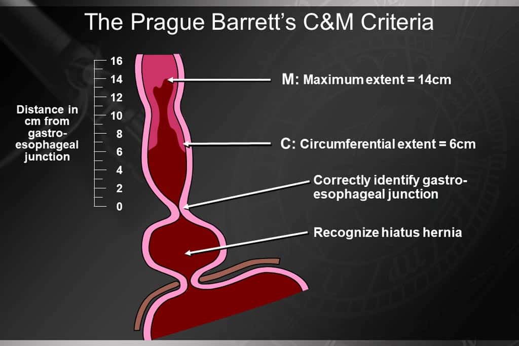 Prague Barrett s C M Criteria IWGCO